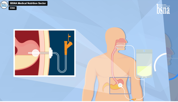BSNA_UK tweet picture