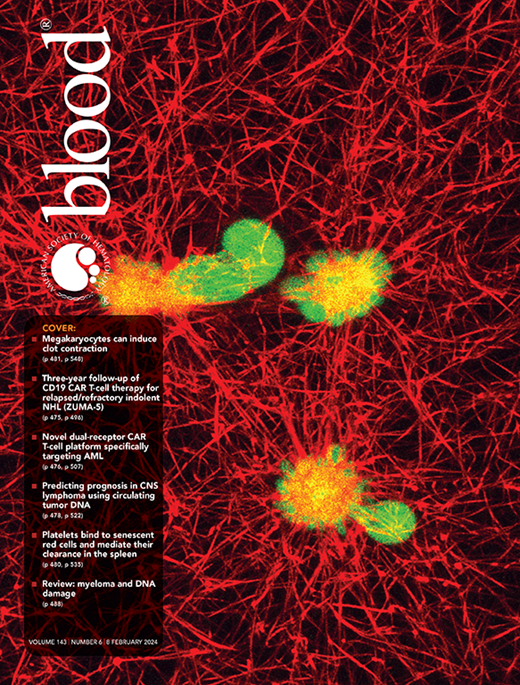 BloodPortfolio's tweet photo. The newest issue of Blood is now available. 
https://t.co/WrQilmsp13
#hematology https://t.co/9fCOAR6SJ6