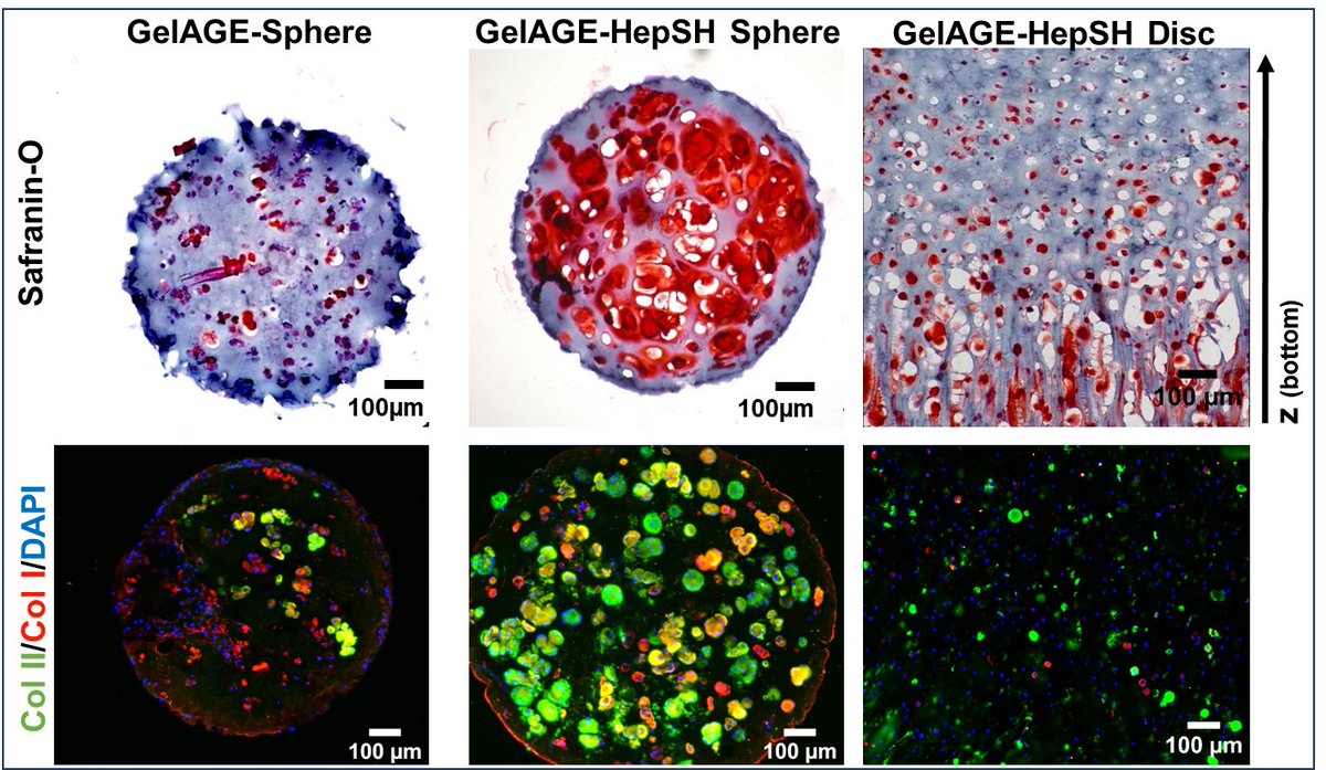 Gabriella Lindberg (@lindberglabs) on Twitter photo Happy to share our latest cartilage work exploring synergistic effects of Heparin, 3D-architectures and oxygen tension in Gelatin bioinks: doi.org/10.3389/fbiom.…
<a href="/Tim_WoodfieldNZ/">Tim Woodfield</a>, <a href="/Khoonono/">Khoon Lim</a>, <a href="/juergengroll/">Jürgen Groll</a>, Tomasz Jüngst, <a href="/Bramzelll/">Bram Soliman</a>, <a href="/AxeNorb/">Axel Norberg</a> Happy to share our latest cartilage work exploring synergistic effects of Heparin, 3D-architectures and oxygen tension in Gelatin bioinks: doi.org/10.3389/fbiom.…
<a href="/Tim_WoodfieldNZ/">Tim Woodfield</a>, <a href="/Khoonono/">Khoon Lim</a>, <a href="/juergengroll/">Jürgen Groll</a>, Tomasz Jüngst, <a href="/Bramzelll/">Bram Soliman</a>, <a href="/AxeNorb/">Axel Norberg</a>