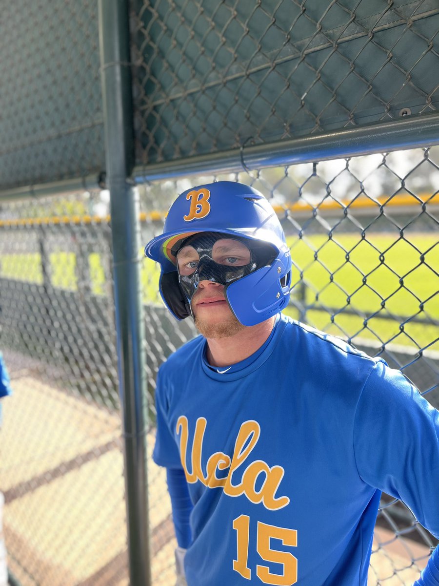 Broken face - no problem.

Tough guy!!!