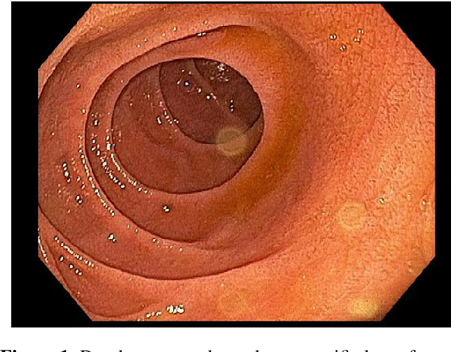 TristanRutland7's tweet photo. 🔬Small bowel, older adult

⚕️Presents with ~3 months of chronic non-bloody diarrhoea and weight loss.

✏️Provided history: Diarrhoea

#MedTwitter #pathtwitter #GIpath #pathresidents https://t.co/YY3HnWo1d0