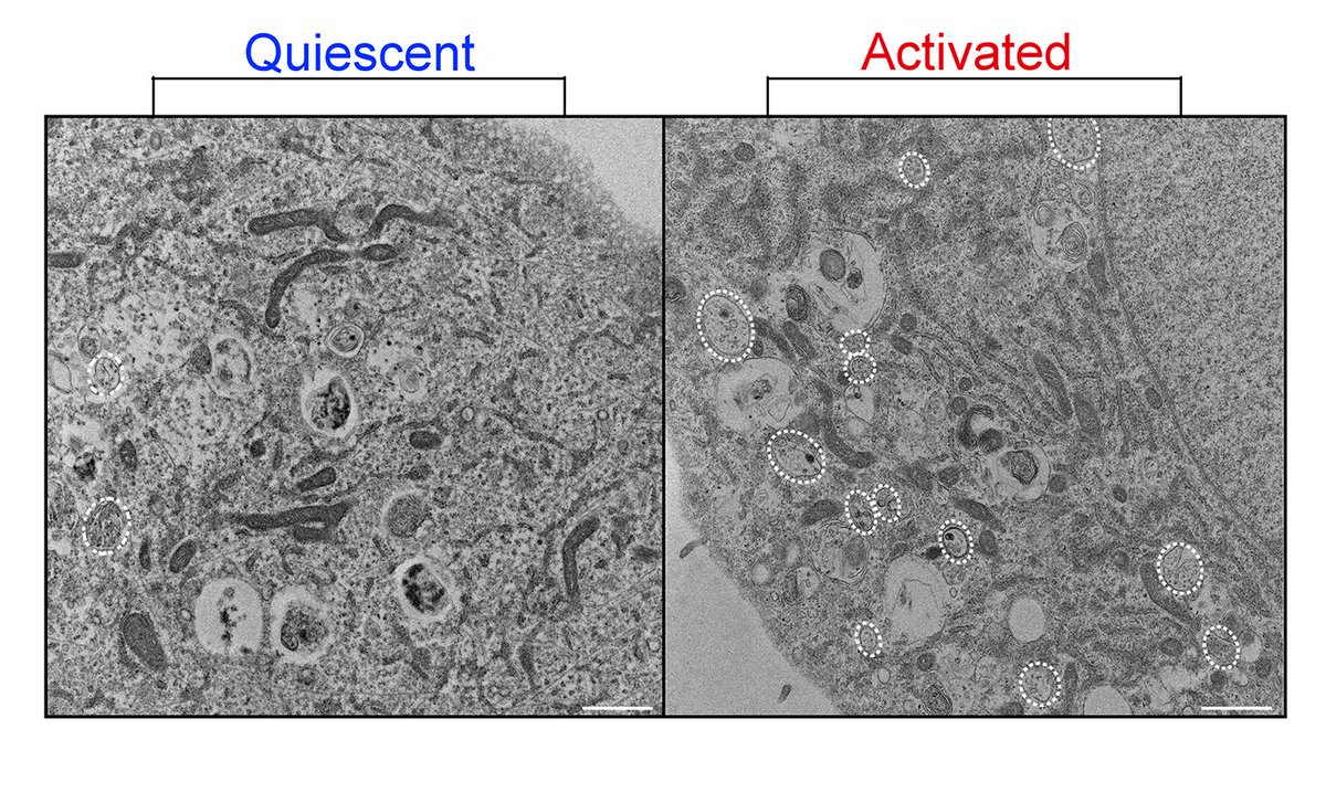 Circulation Research (@circres) on Twitter photo @sneharajumd found #ECs release small #EVs bidirectionally can reprogram cells in discrete #vascular compartments towards an athero-prone signature. ahajrnls.org/3w6dUJz
<a href="/AikawaElena/">Elena Aikawa</a> @warrenleelab <a href="/toleafgirl/">sasha</a> <a href="/TseWingWinnieHo/">Tse Wing Winnie Ho</a> <a href="/caseylclift/">Cassandra L. Clift, PhD</a> <a href="/SRBotts/">Steven Botts</a> <a href="/kat_howe/">Kathryn Howe</a> <a href="/FishLab_UHN/">Jason Fish</a> @sneharajumd found #ECs release small #EVs bidirectionally can reprogram cells in discrete #vascular compartments towards an athero-prone signature. ahajrnls.org/3w6dUJz
<a href="/AikawaElena/">Elena Aikawa</a> @warrenleelab <a href="/toleafgirl/">sasha</a> <a href="/TseWingWinnieHo/">Tse Wing Winnie Ho</a> <a href="/caseylclift/">Cassandra L. Clift, PhD</a> <a href="/SRBotts/">Steven Botts</a> <a href="/kat_howe/">Kathryn Howe</a> <a href="/FishLab_UHN/">Jason Fish</a>