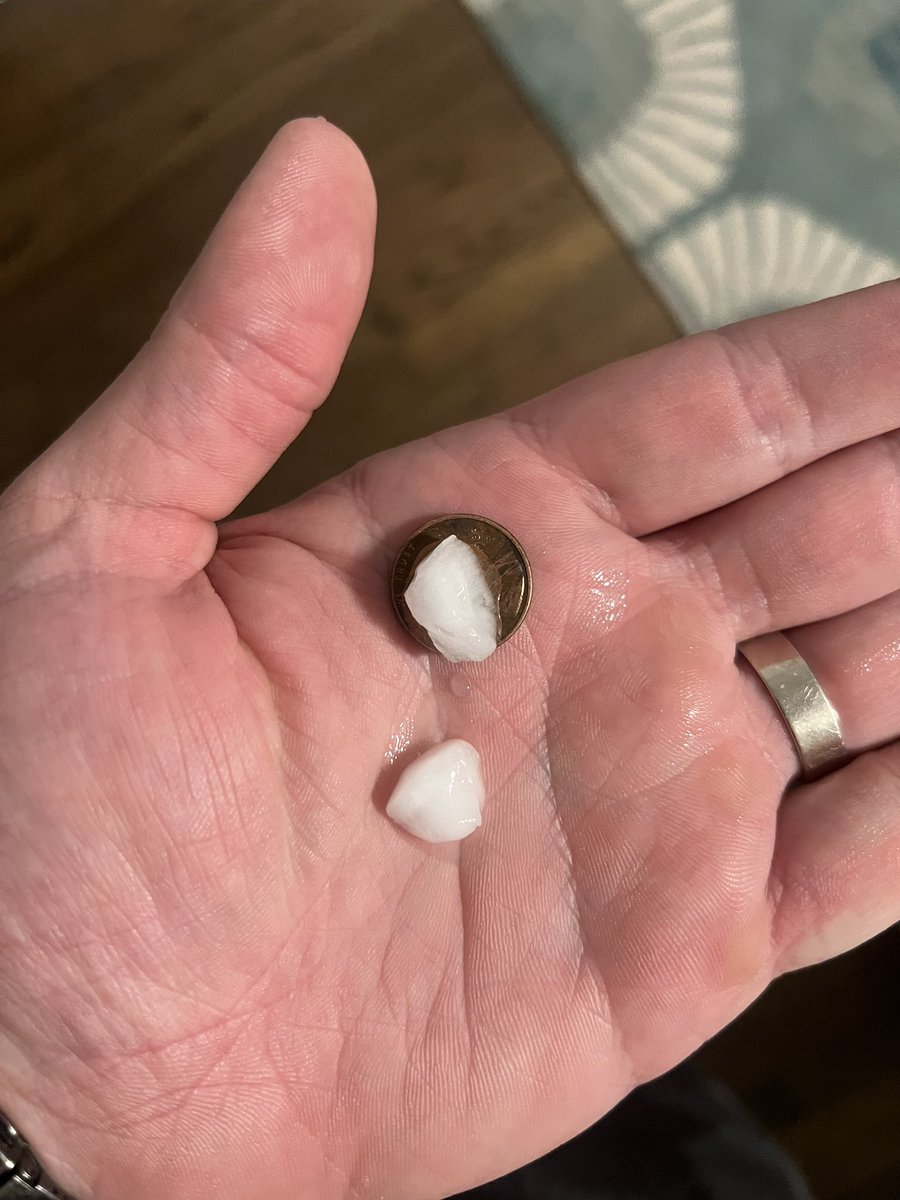 Penny sized hail near Sauganash. In February! <a href="/WGNNews/">WGN TV News</a>