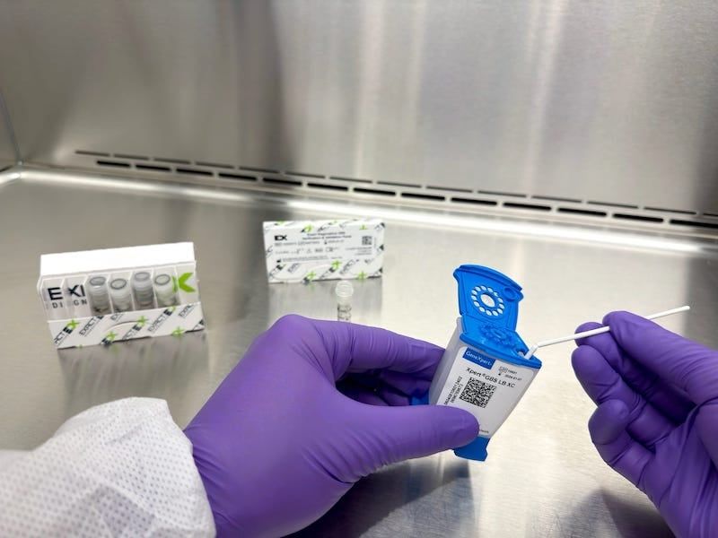 CLPmag's tweet image. Adequately designed and clinically relevant QCs are a cornerstone in ensuring the reliability of Group B Streptococcus test results. Read here: buff.ly/48cNnrF #clinicaldiagnostics #qc #qcs #qualitycontrols #diagnostictest #diagnostictesting #exactdiagnostics