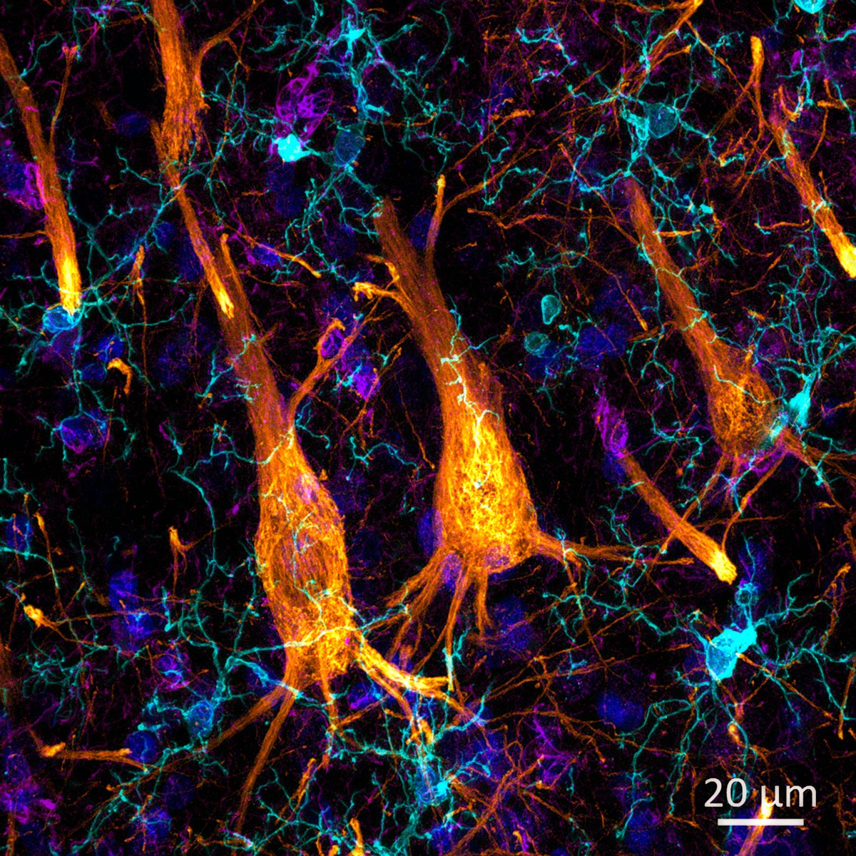 I was looking at some pyramidal neurons from the prefrontal cortex today in the microscope... most of them are not so pyramidal, usually more pear-shaped 😁? Additional markers: microglia (cyan), astrocytes (🟣), nuclei (🔵)