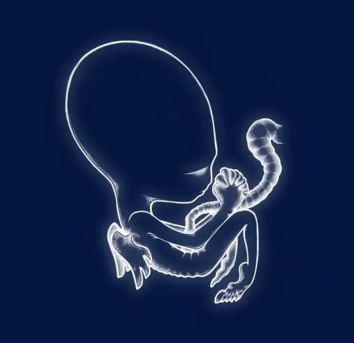 Macusss33's tweet image. My fav albums of 1999!

Reply for a year