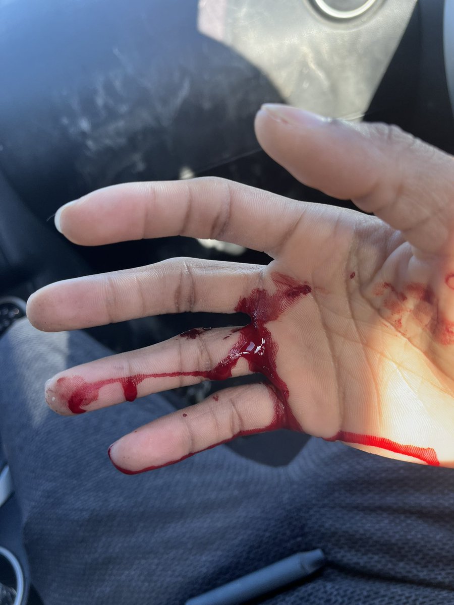 ُأسامة tweet media