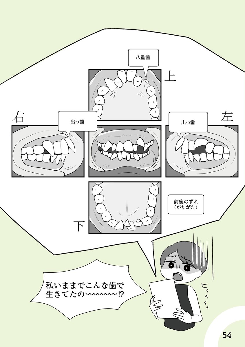 自分を好きになるために歯並びを治してみた～5年5か月100万円!大人の歯列矯正物語～②(2/6) 