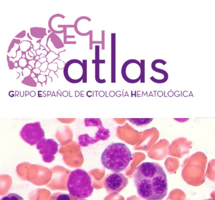 La Dra Azaceta nos actualiza la situación del Atlas del GECH, herramienta docente muy útil para todos los hematólogos. Anímate a enviar imágenes! Normas de envío de imagenes: gechem.org/index.php?opti…