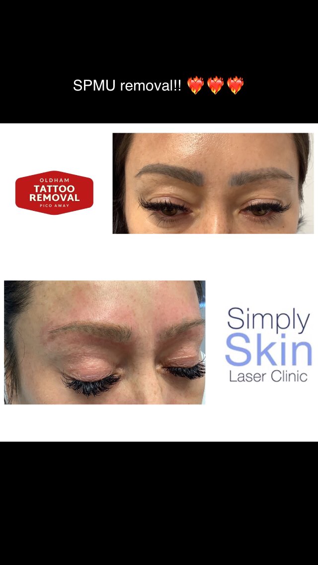 Simplyskin16's tweet photo. https://t.co/lfFgSK1Gl9