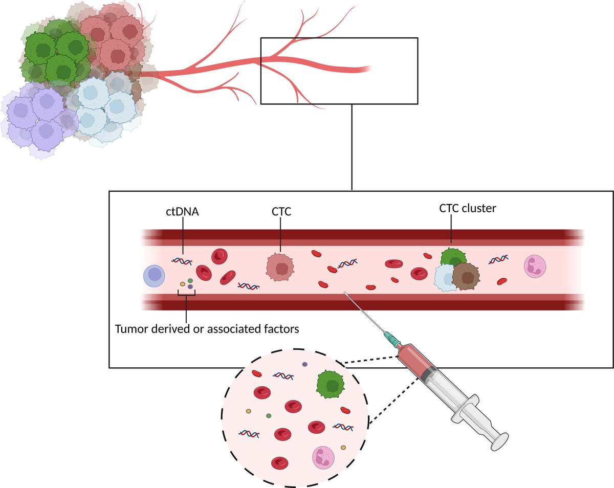 Circulating tumor DNA as a Predictive and Prognostic Biomarker in the Perioperative Treatment of Muscle-invasive Bladder Cancer: A Systematic Review buff.ly/3umB8uv @emanuele_crupi @LauraMarandino @DanieleRaggi83 @sonpavde @UroDocAsh @AndreaNecchi #UroSoMe