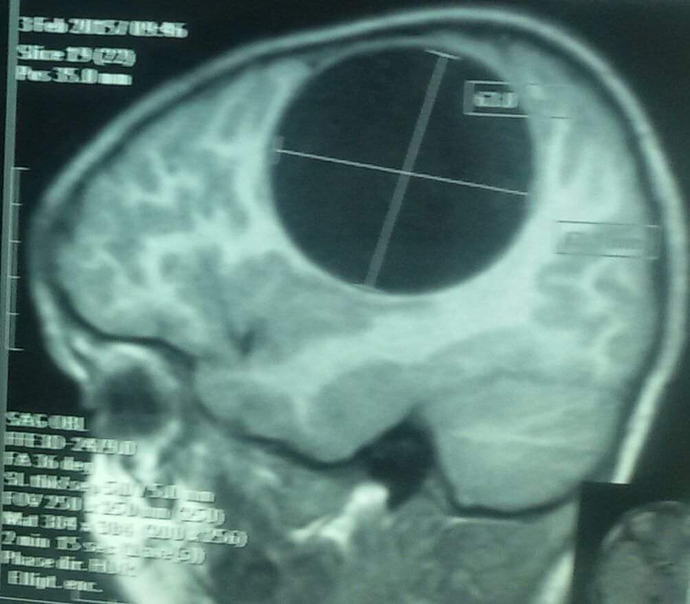Neurosurgery Cocktail tweet media