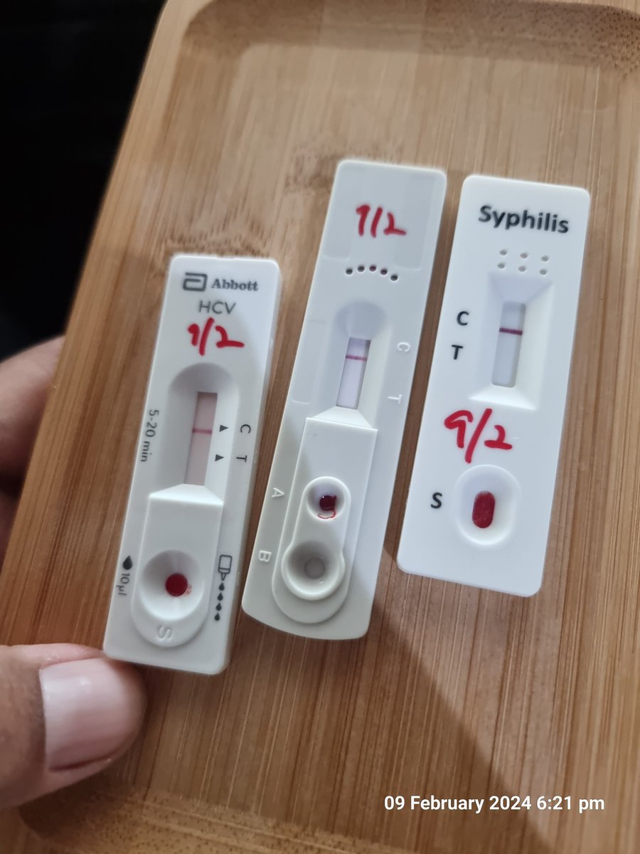 Bobboi85's tweet photo. Done buat test selepas almost due nak 3 bulan. Ghisau juga sbb termenyundal lebih bulan 1 hr tu. ๐
NGO yg biasa buat tu tiba2 dm tanya. Apa lagi onz jela sbb dah nearby. ๐๐
#loveyourself
#getyourselfchecked
#hivawareness https://t.co/LZBr5QWeaW