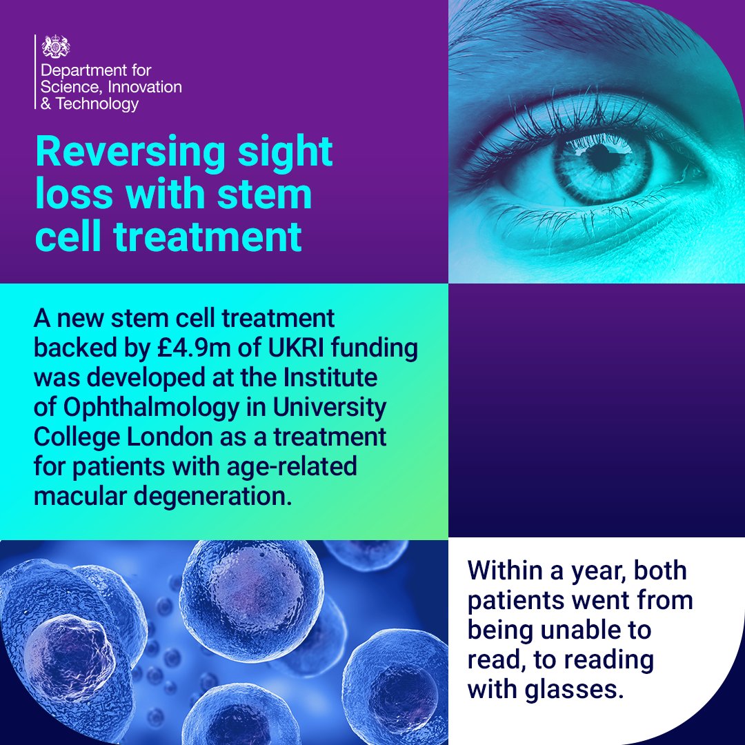 Age-Related Macular Degeneration is the most common cause of sight loss, affecting over a quarter of people over 65 in the UK.

Within 12 months two patients were able to regain sight following stem cell treatment at <a href="/ucl/">UCL</a> ✔