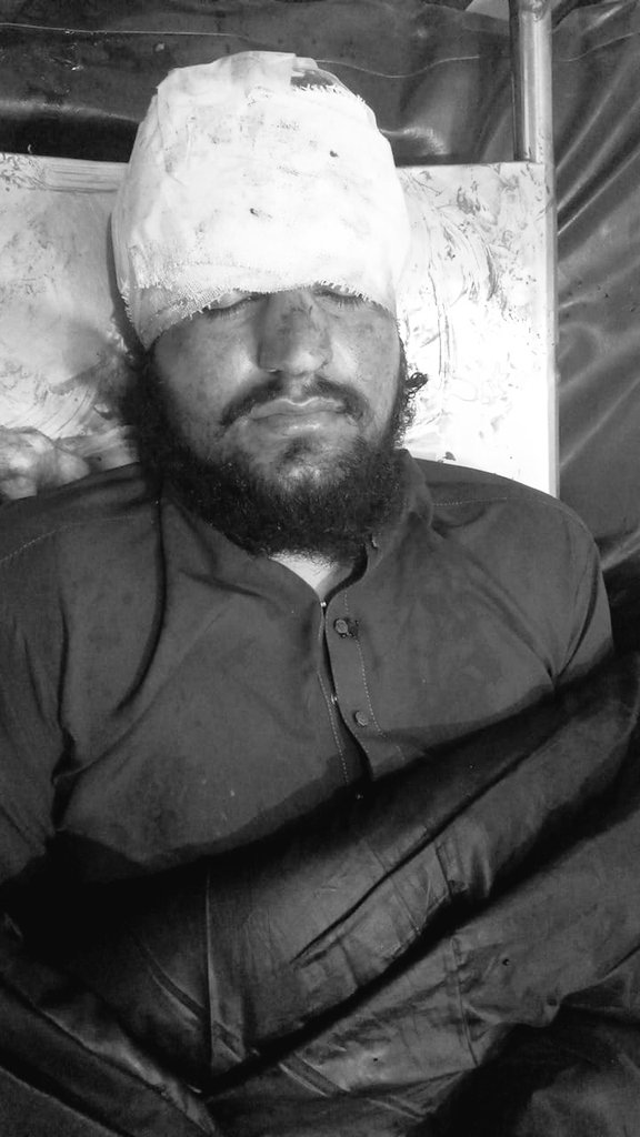 shadabyousufxai's tweet photo. There is a state of insurgency in District Shangla NA11. Police have opened Direct Fire on the protestors of PTI which resulted in the death of 5 people and nearly 19 injuries. Shangla is bleeding! 💔
#Shangla #NA11 #ShanglaisBleeding #PTI #GeneralElectionN0W #ElectionResults https://t.co/hxdeUFAfaf