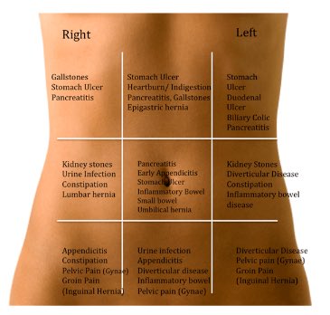 OGdukeneurosurg's tweet photo. More detailed than Pain in the belly https://t.co/ZHx67J5XFz