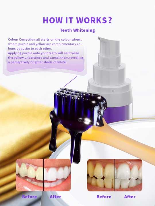 teledenteractiv's tweet photo. #teethcleaning
#smile #teeth #dentist #dentistry #dental #whiteteeth #cosmeticdentistry #smilemakeover #veneers #dentalcare  #dentalhygiene #dentalclinic #tooth #dentalhygienist #teethwhiteningkit #whitening #whitesmile  #smiledesign #v34 #colourcorrector #teethcolourcorrectour https://t.co/0QqmyqYttU