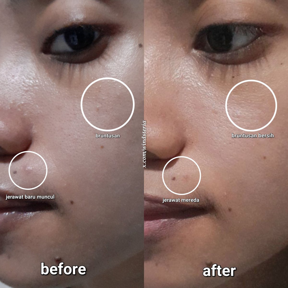 windsteria's tweet photo. Progressnya ada bgt nih pake ceramide serum satu ini😭💖
Ngga salah emang kalo jadi hidden gem andalanku tiap kulit lagi sensi-sensinya trs gampang breakout, pilihan yang tepat &amp; wajib direpurchase~ ngga rugi dong! https://t.co/VC1Kyc0BBT