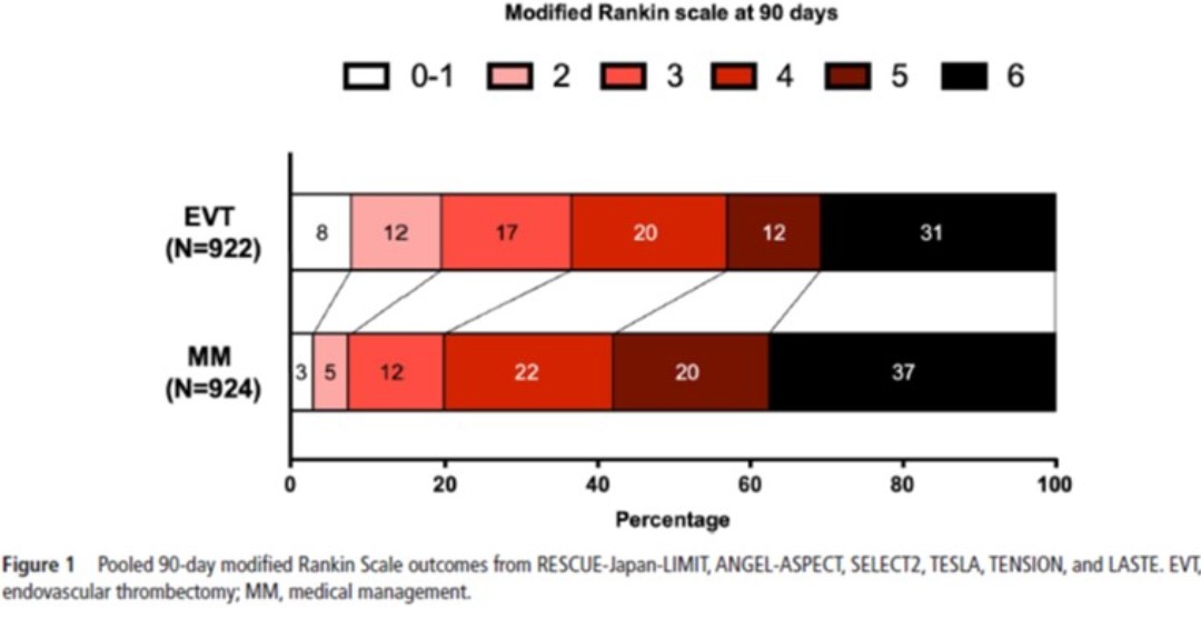 Its official, size doesn’t matter! @marcocolasurdo et al provide a meta-analysis bit.ly/3UuQOqe of 6 RCTs showing the benefit of EVT in LVO with ASPECTS 3-5 within 6 hours of LKW. NNT = 4.7 for mRS 0-2 outcomes over medical management. #strokecare #thrombectomy