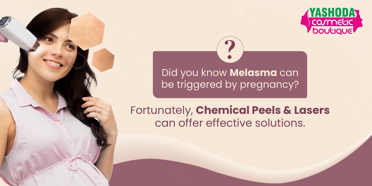 About 15%-50% of women complain about #Melasma during pregnancy, but fortunately, #ChemicalPeels & #Laser can competently tackle the problem. Book now and avail our #ValentinesSpecialOffer - 25% Discount on all cosmetic procedures. Call: +91 98712 59996 #YashodaCosmeticBoutique