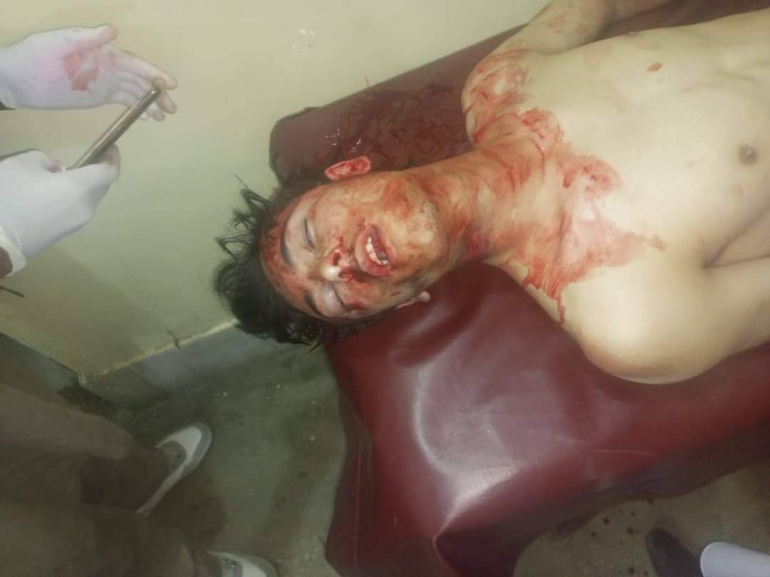 Samraimran95's tweet photo. At least two young men have been marryred in Alpuri, Shangla by Amir Muqam's death squads. (Including police)
Reports of more wounded and atleast one more in critical condition. #Alpuri #Shangla
#ElectionResults
#ElectionResult
#GeneralElectionN0W #Elections2024 #PakistanElection #PakistanElection #PakistanArmy