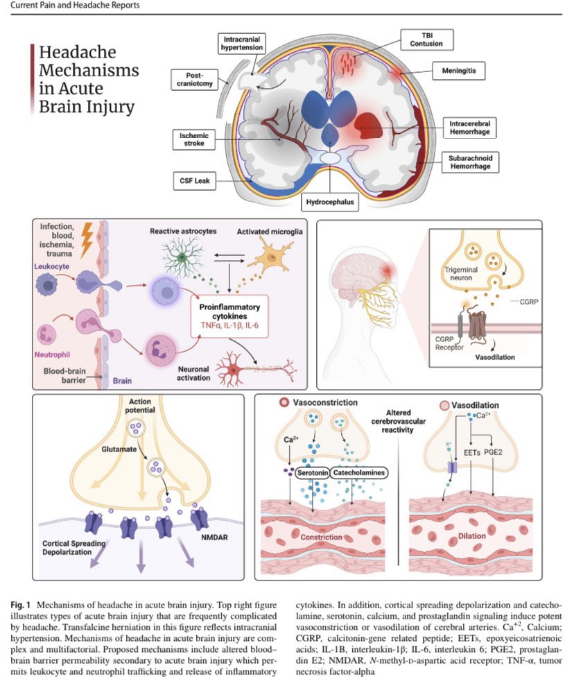 Headache Management in the Neuroscience Intensive Care Unit @neurologyrules @BuslKatharina @theABofPharmaC #MedEd #MedX #ICU #Headache #Medical #neuroscience link.springer.com/article/10.100…