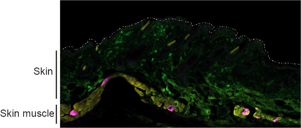 Mosquito bite location – face, neck, and hand muscles – could determine whether viral infection occurs, new mouse study of La Crosse virus from NIAID and UMN shows. nature.com/articles/s4146…