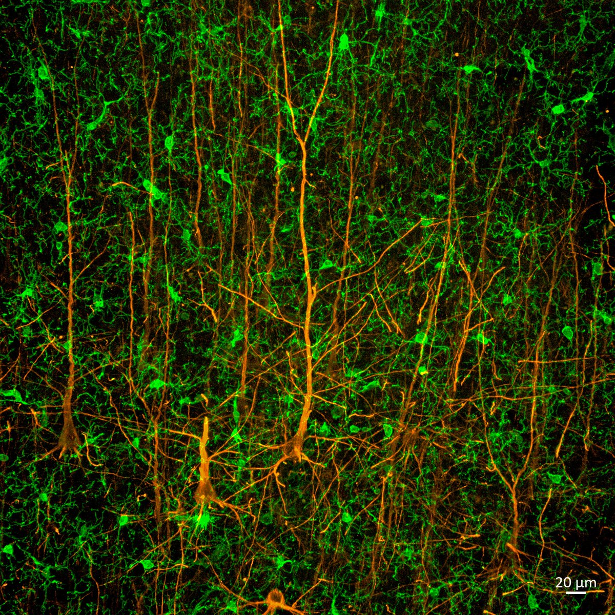 Happy #FluorescenceFriday! There is a forest inside your head 🧠🔬. Neurons &amp; microglia!