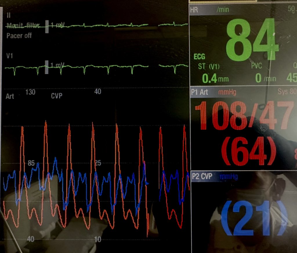 Matt Siuba tweet media
