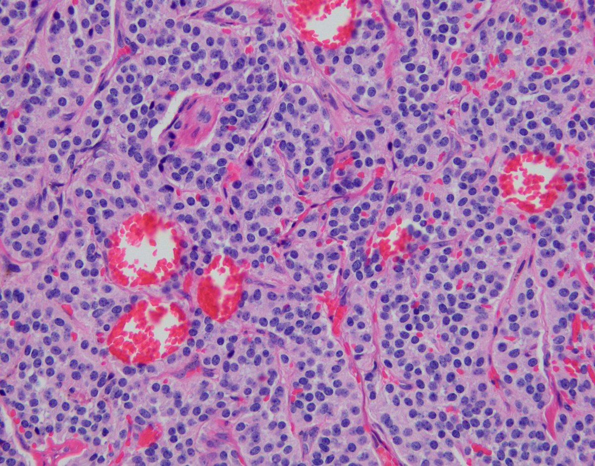 Jared T. Ahrendsen MD, PhD (AP/NP/FP) tweet media