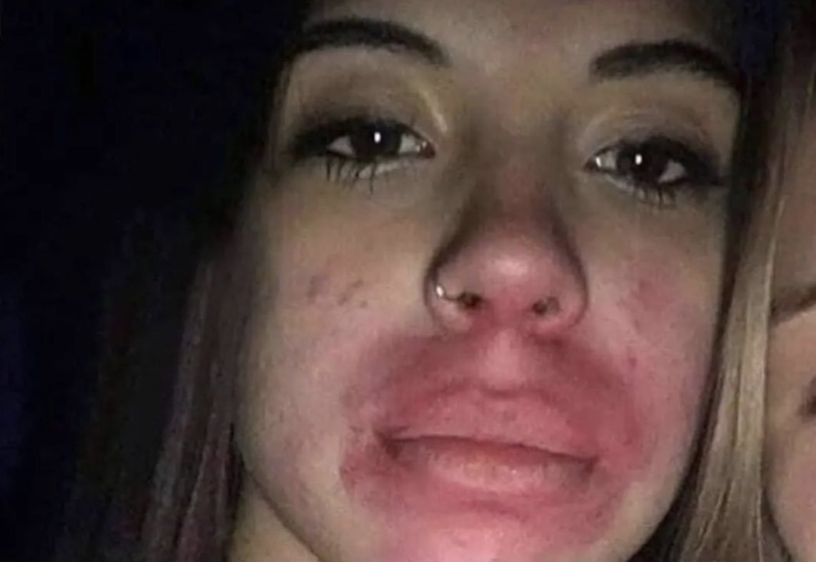 *Dejo a mi amiga sola 10min en la fiesta*   

Mi amiga: