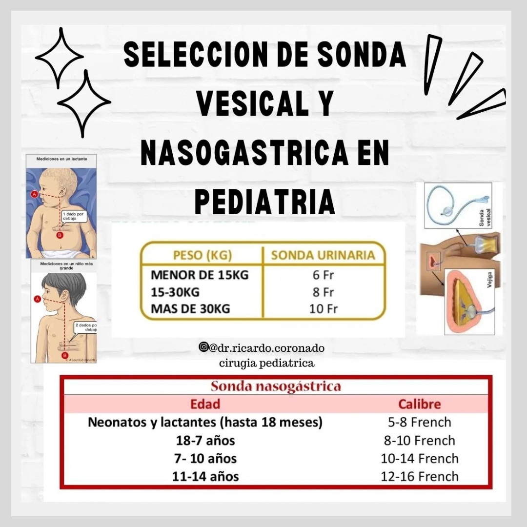 La selección de #sondasvesicales y nasogástricas en #pediatría depende de varios factores, como la edad del niño, el propósito de la intervención y las condiciones clínicas.
.
Infografía #drricardocoronado 
#formacionsanitaria #sondanasogástrica #cursosonline