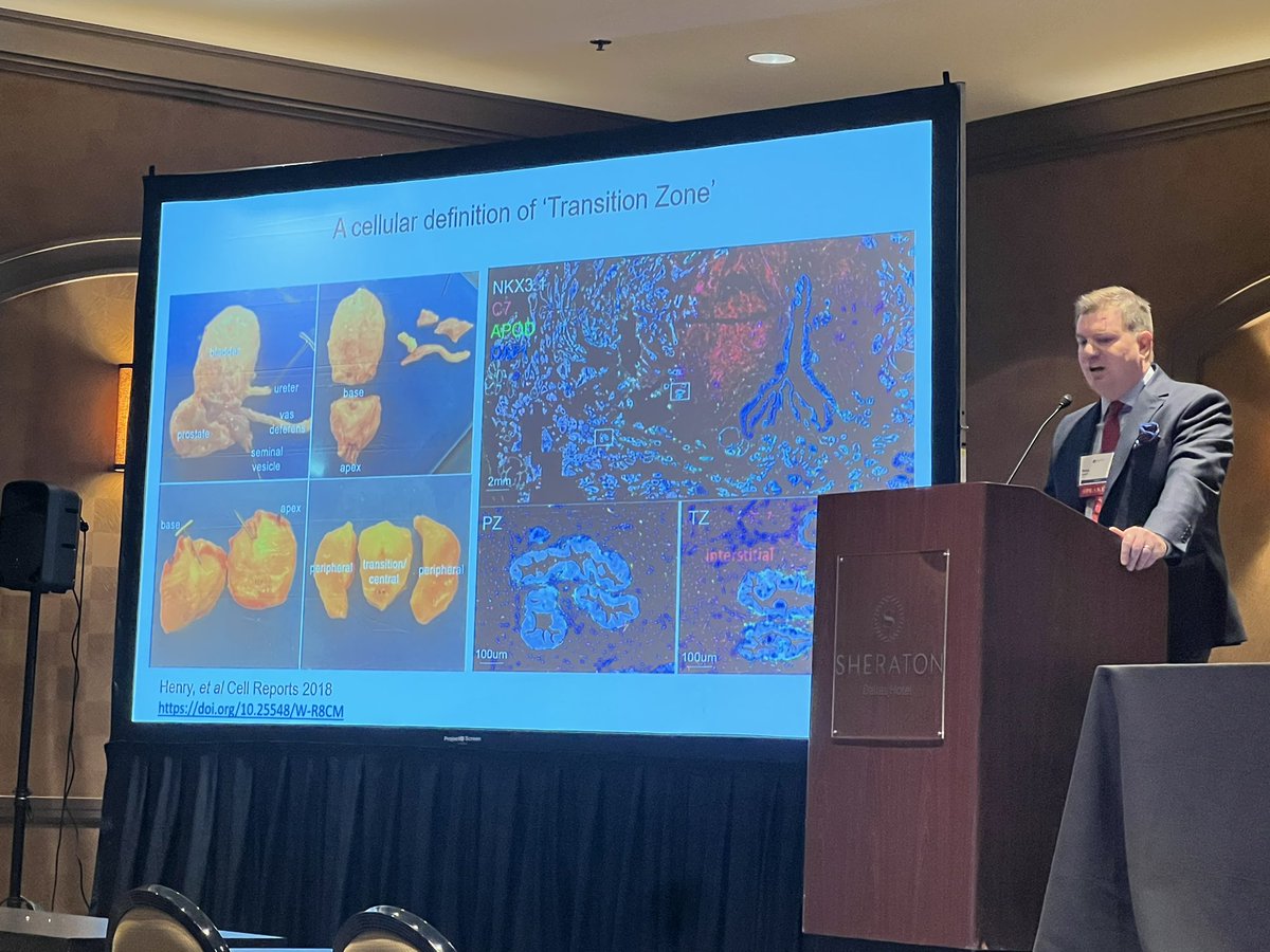 Takeaways from the AM session <a href="/SocietyofBPD/">BPDSociety</a>. We are going to be living longer, untreated obstruction leads to fibrosis/collagen deposition. #urologists need to be aggressive regarding prevention and medical/surgical therapies for BPH