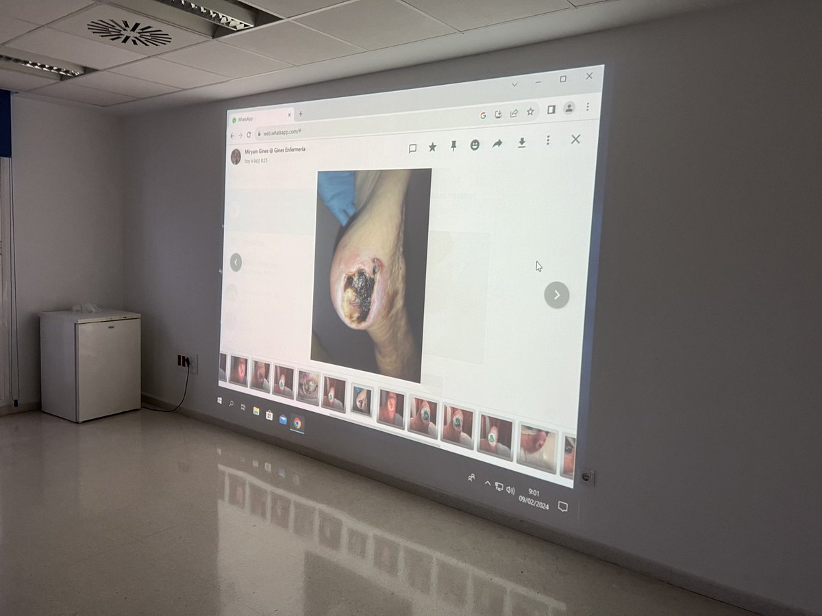 EPAHERIDASCC's tweet photo. Sesiones clínicas sobre casos de pacientes con #heridas complejas para asesorar a los profesionales en sus propios centros y en equipo 
Hoy GINES
#DSASN ✅ “Acercando la @epaheridas_dsasn a los profesionales” https://t.co/oa2abN1Hjn