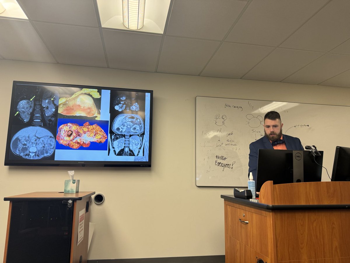 gudnephron's tweet photo. Phenomenal talk on Tuberous Sclerosis - Adult 🫘 implications - Nephrology Grand Rounds

By ⁦@drjakenysather⁩ Sharing his exp and cases from his MD TS Clinic 

⁦@UCKidney⁩ ⁦@UCincyMedicine⁩ ⁦@UCincyIM⁩ ⁦@CincyChildrens⁩
#Nephrogenetics https://t.co/Xo4iPf6PQk