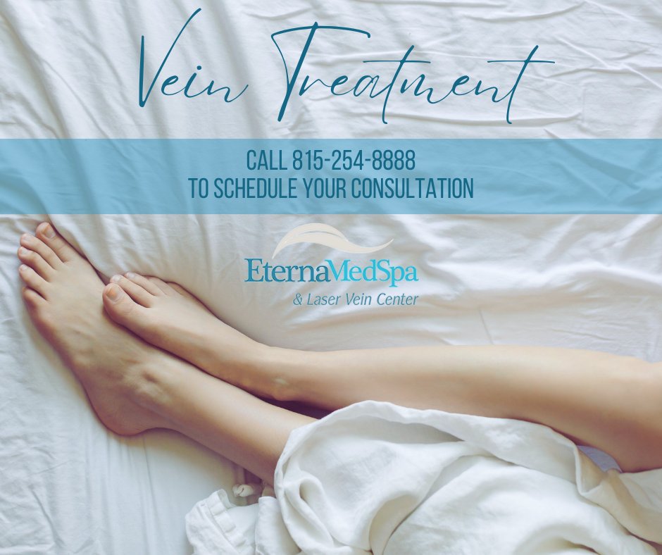 EternaMedSpa's tweet photo. Are you thinking about treating your varicose or spider veins? Contact Eterna MedSpa &amp; Laser Vein Center for a consultation, and visit our website to learn more about our vein treatment services! https://t.co/oAhfu5hntF https://t.co/Ebjlz9mX2c