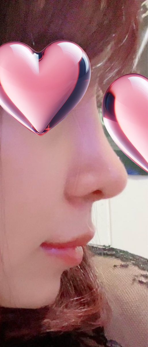 temporary5862's tweet photo. 左DT1ヶ月 
右 今日の鼻 👃思い出したらDT鬱的なものが2週間くらいしかなかった気がするけどそれって高さとかあんまり変えてないからなのかな。。今は気に入ってるけど元から口元が前に出ているタイプだから鼻はもっと高さがあってもよさそうってたまに頭をよぎる🤭。。 https://t.co/Gx0rqRsxSA