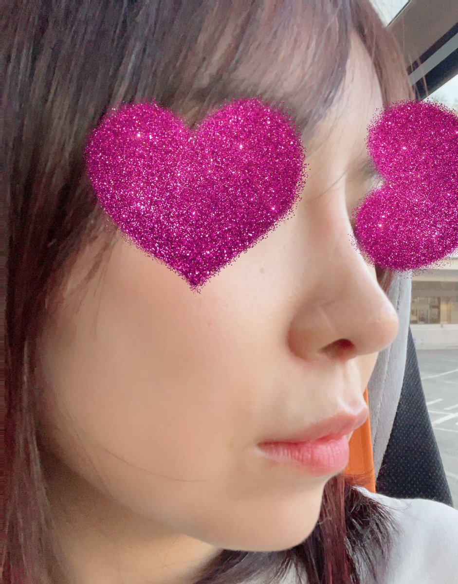 temporary5862's tweet photo. 左DT1ヶ月 
右 今日の鼻 👃思い出したらDT鬱的なものが2週間くらいしかなかった気がするけどそれって高さとかあんまり変えてないからなのかな。。今は気に入ってるけど元から口元が前に出ているタイプだから鼻はもっと高さがあってもよさそうってたまに頭をよぎる🤭。。 https://t.co/Gx0rqRsxSA