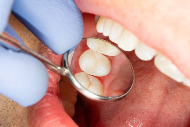 bolivardental's tweet photo. Poor oral health has been linked to other health issues such as heart disease, diabetes, and premature birth. #DidYouKnow #InterestingFact #ImportantFact https://t.co/Ilda2OL6IT