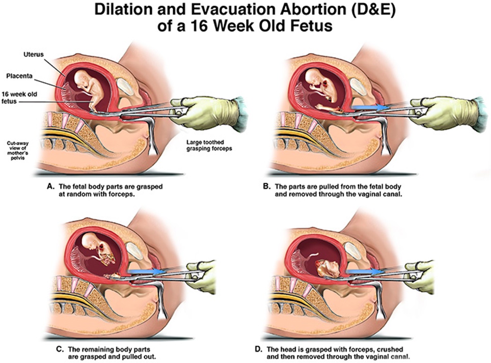 Abolition__Now's tweet image. If you support this, don’t lecture me on “bodily integrity”.