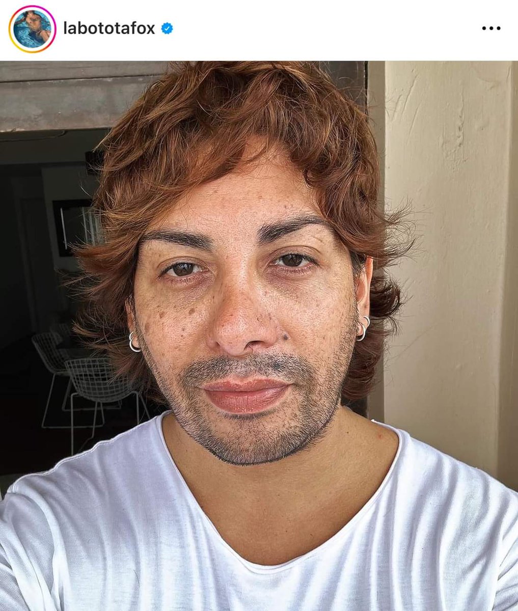 donmerelo's tweet photo. La botota se cortó el pelo en homenaje el chico terry https://t.co/xPQPIbvQW9