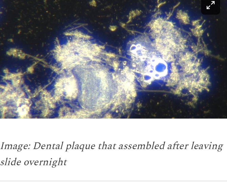 "Doc, My Dental Plaque Is Blinking" - Darkfield Microscopy Of Dental Plaque Scraping

Read it here: anamihalceamdphd.substack.com/p/doc-my-denta…