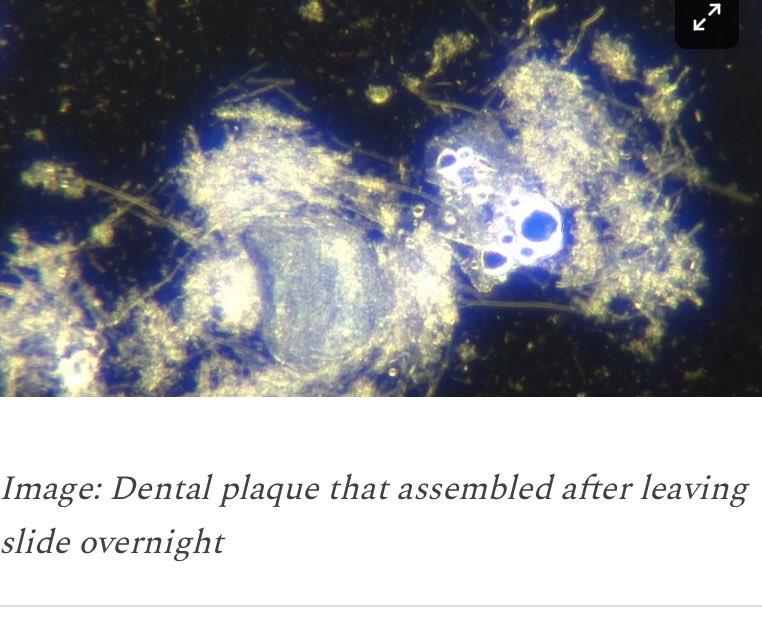'Doc, My Dental Plaque Is Blinking' - Darkfield Microscopy Of Dental Plaque Scraping Read it here: anamihalceamdphd.substack.com/p/doc-my-denta…