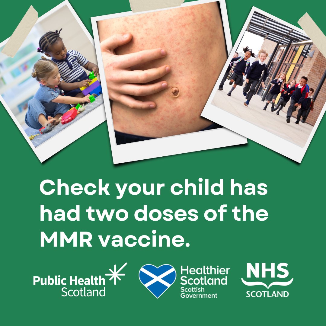 Cases of measles are on the rise. That's why it's important that children and young people are fully vaccinated. 
For more information visit nhsinform.scot/MMRagainstMeas…
#MMRagainstMeasles