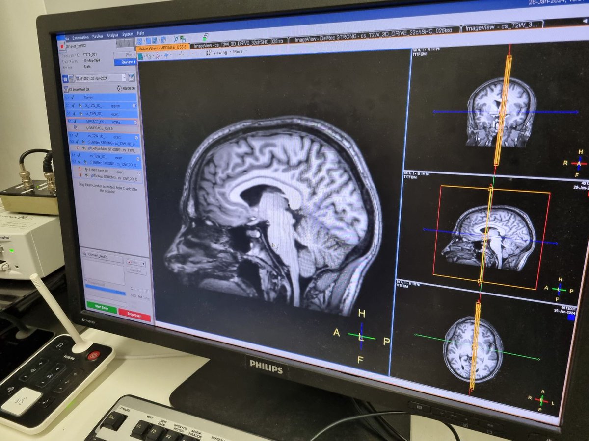 The Lumen Lab (@thelumenlab) on Twitter photo <a href="/OJBurton/">Oliver Burton</a> looking relaxed after spending an hour in the <a href="/SPMIC_UoN/">SPMIC</a> 3T MRI scanner courtesy of <a href="/rebecca_penguin/">Rebecca π§</a>.
Looking forward to seeing what we can do with the data! <a href="/OJBurton/">Oliver Burton</a> looking relaxed after spending an hour in the <a href="/SPMIC_UoN/">SPMIC</a> 3T MRI scanner courtesy of <a href="/rebecca_penguin/">Rebecca π§</a>.
Looking forward to seeing what we can do with the data!