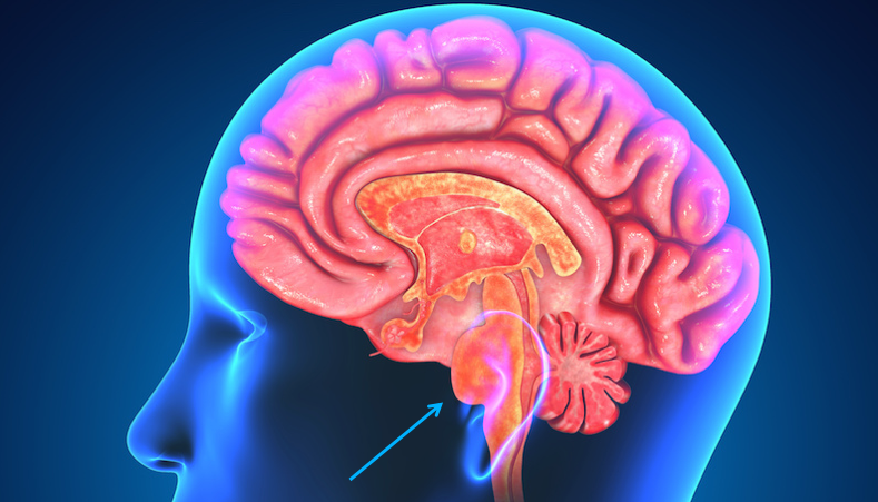 jimmunoallerg's tweet photo. Medulloblastomas are embryonal tumors but have their own genetically (molecular) and histologically defined groups.
#tumor #immunology #embryonal #chromosomes #rosette #Medulloblastomas #allergicreactions #C19 #brain #genetics #embryonaltumor #amplification #histology #medulla https://t.co/mM5gcS99MW