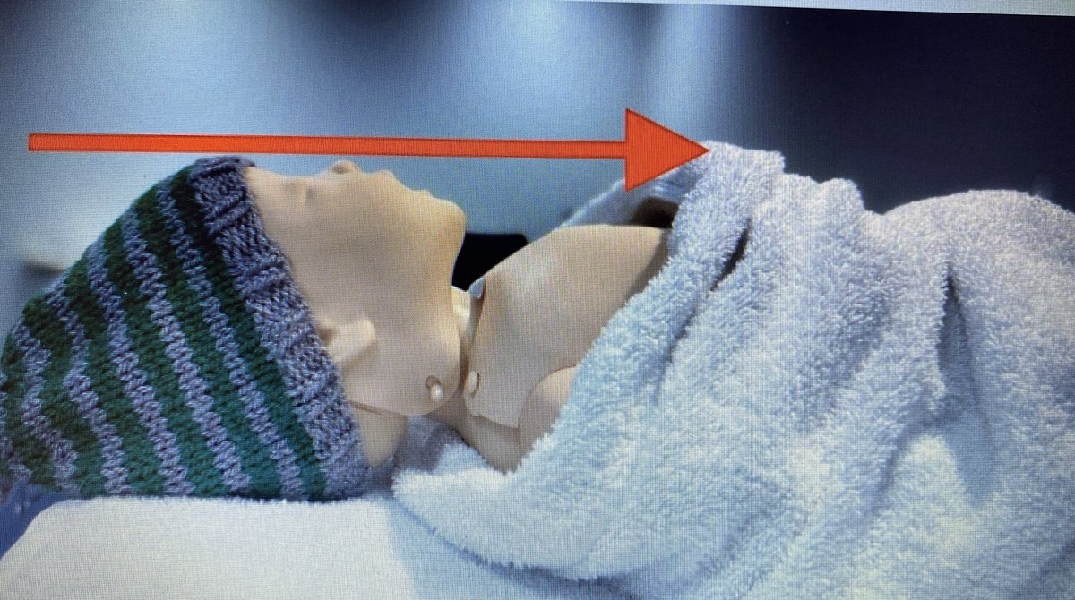 When thinking about neonatal ventilation - head positioning is key and the most common cause of failure - @jamesjj225 
#BigOcciput #CPD #PRU #PHEM