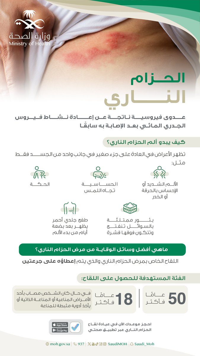SaudiMOH's tweet photo. بإمكانك تجنّب الحزام الناري وحماية نفسك بأخذك اللقاح بإذن الله. https://t.co/9NLGeSaufL