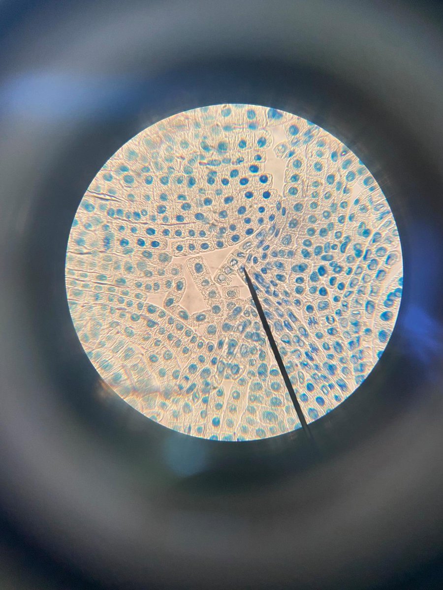 KirkhamGrammar's tweet photo. @KirkhamGrammar Lower Sixth A Level Biology pupils carrying out their second required practical this morning - preparing and observing mitosis in garlic root tips.
#requiredpractical #alevelbiology #preparation #observation #mitosis #lowersixthform @KGSBiology https://t.co/ZGxLd34v9s