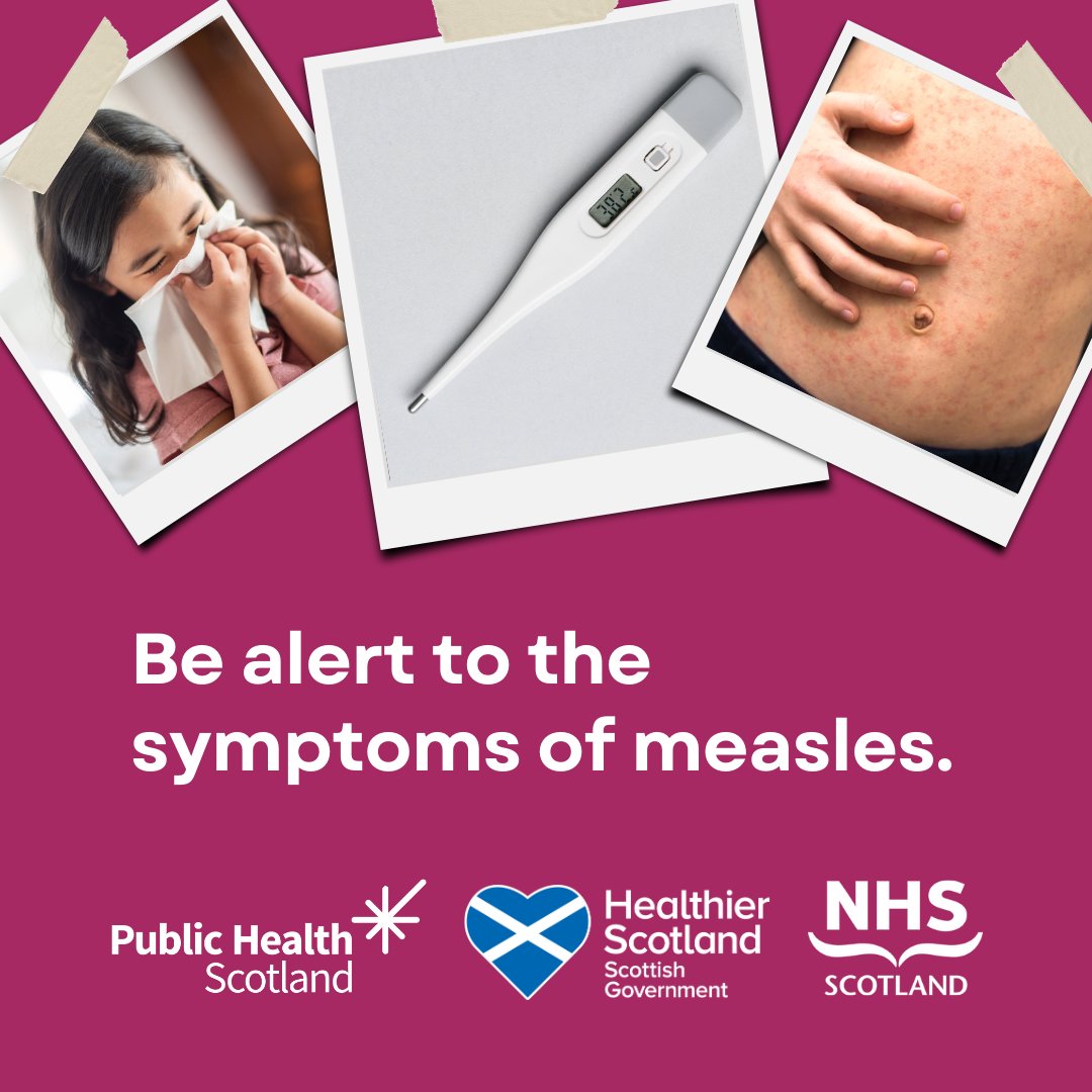 Cases of measles are on the rise. So, it’s important to be aware of the symptoms. Find out about the signs and what to do if you think you or your child has measles at nhsinform.scot/MMRagainstMeas… #MMRagainstMeasles